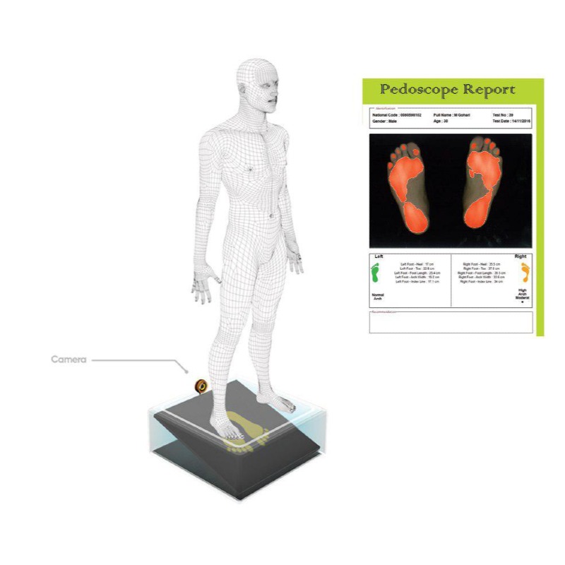 پدوسکوپ دوربین‌دار با نرم‌افزار