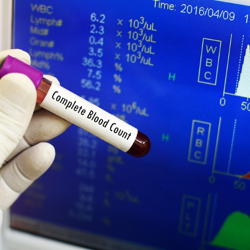 شمارش منتخبی از شاخص های خونی و CBC