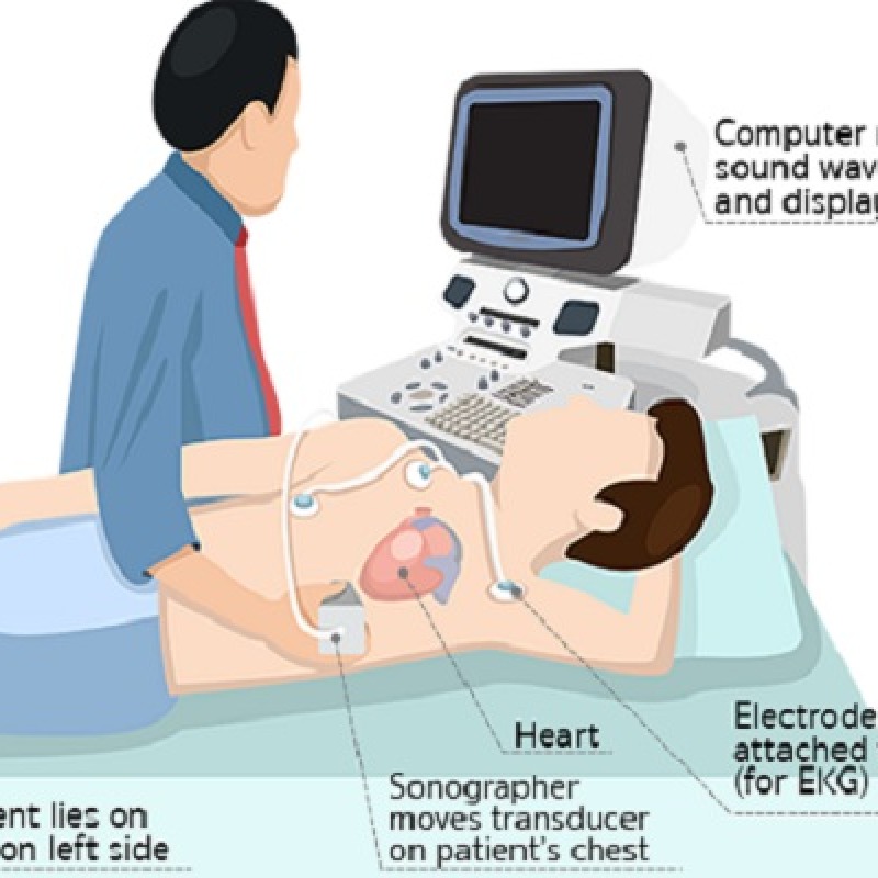 اشنایی با اکوکاردیوگرافی و واژگان شناسی در آن