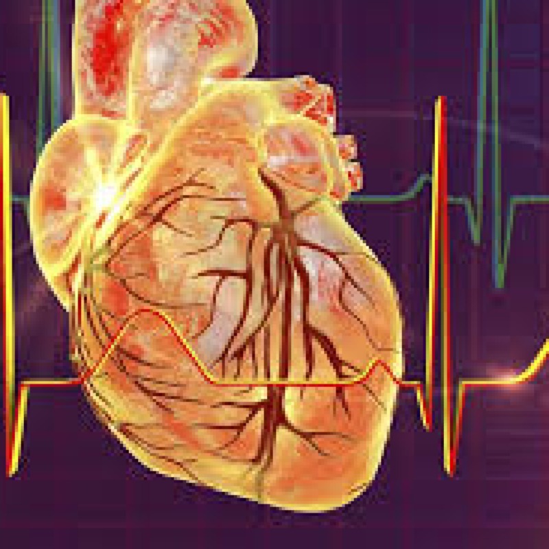 تشخیص هایپرتروفی در قلب به وسیله الکتروکاردیوگرام