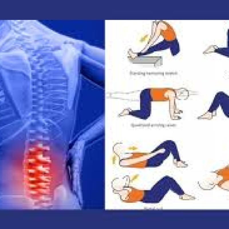 کمردرد و فعالیت ورزشی